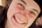 thumb3