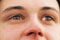 thumb3