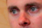 thumb5